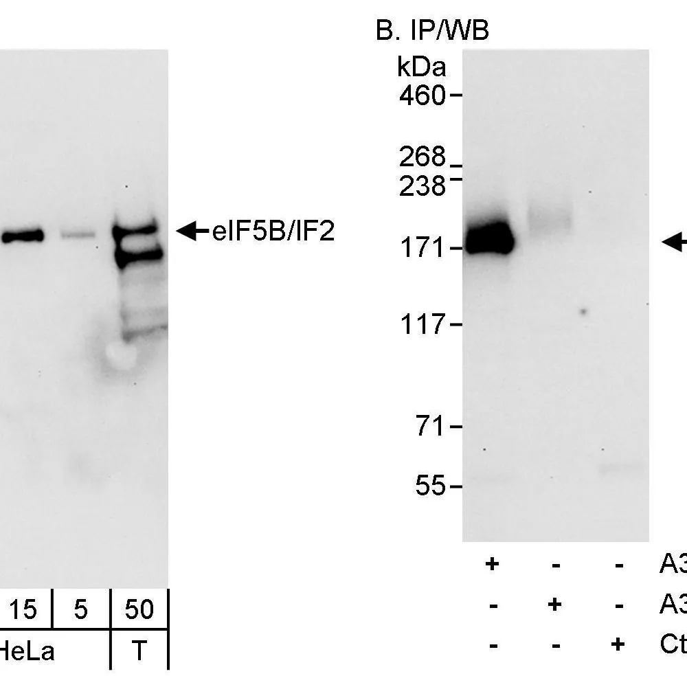 Rabbit anti-eIF5B/IF2 Antibody, Affinity Purified