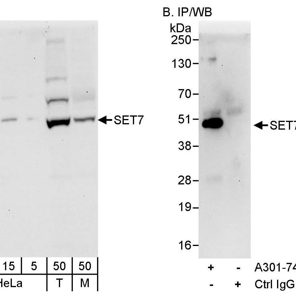 Rabbit anti-SET7 Antibody, Affinity Purified