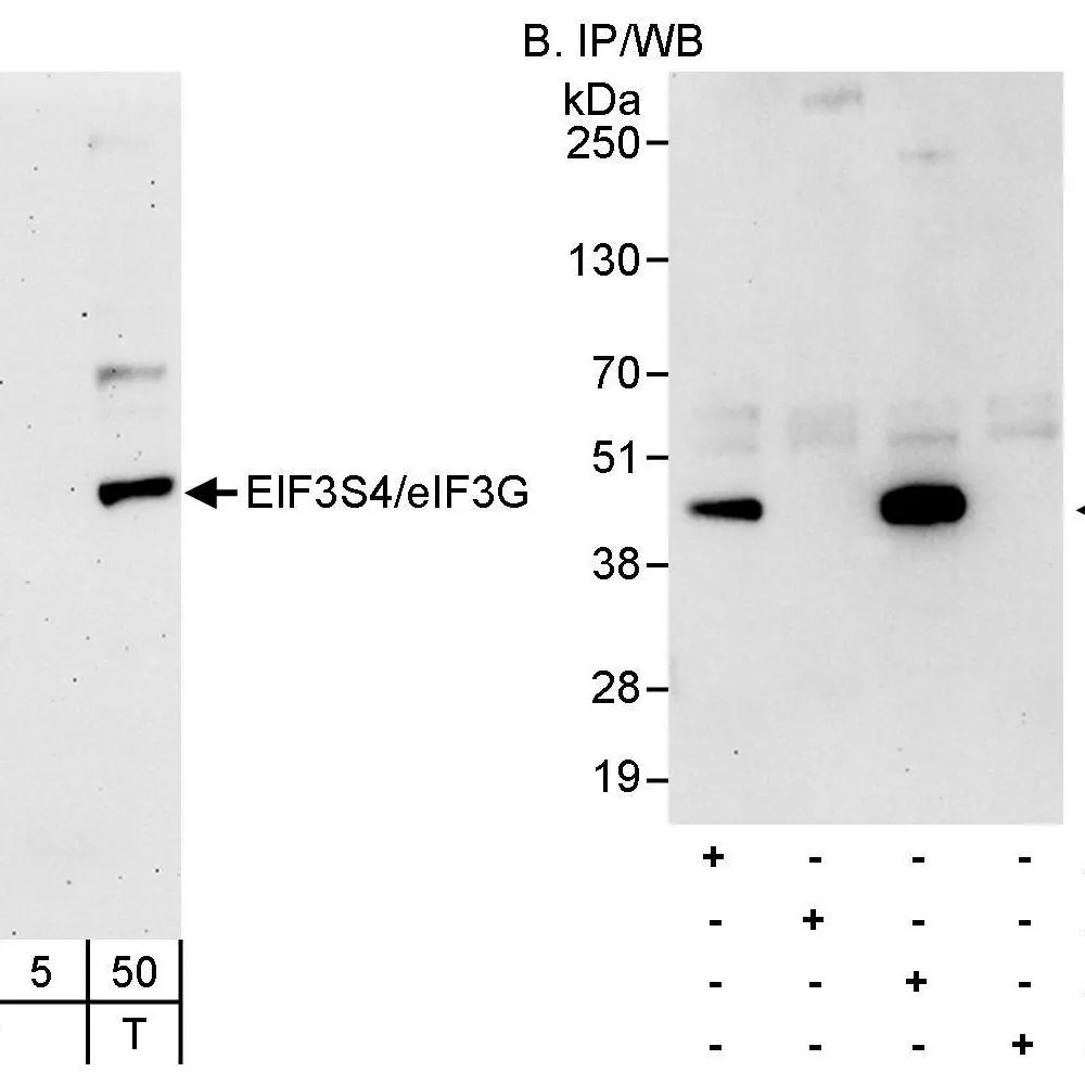 Rabbit anti-eIF3G/EIF3S4 Antibody, Affinity Purified