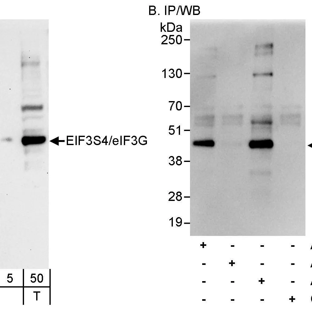 Rabbit anti-eIF3G/EIF3S4 Antibody, Affinity Purified