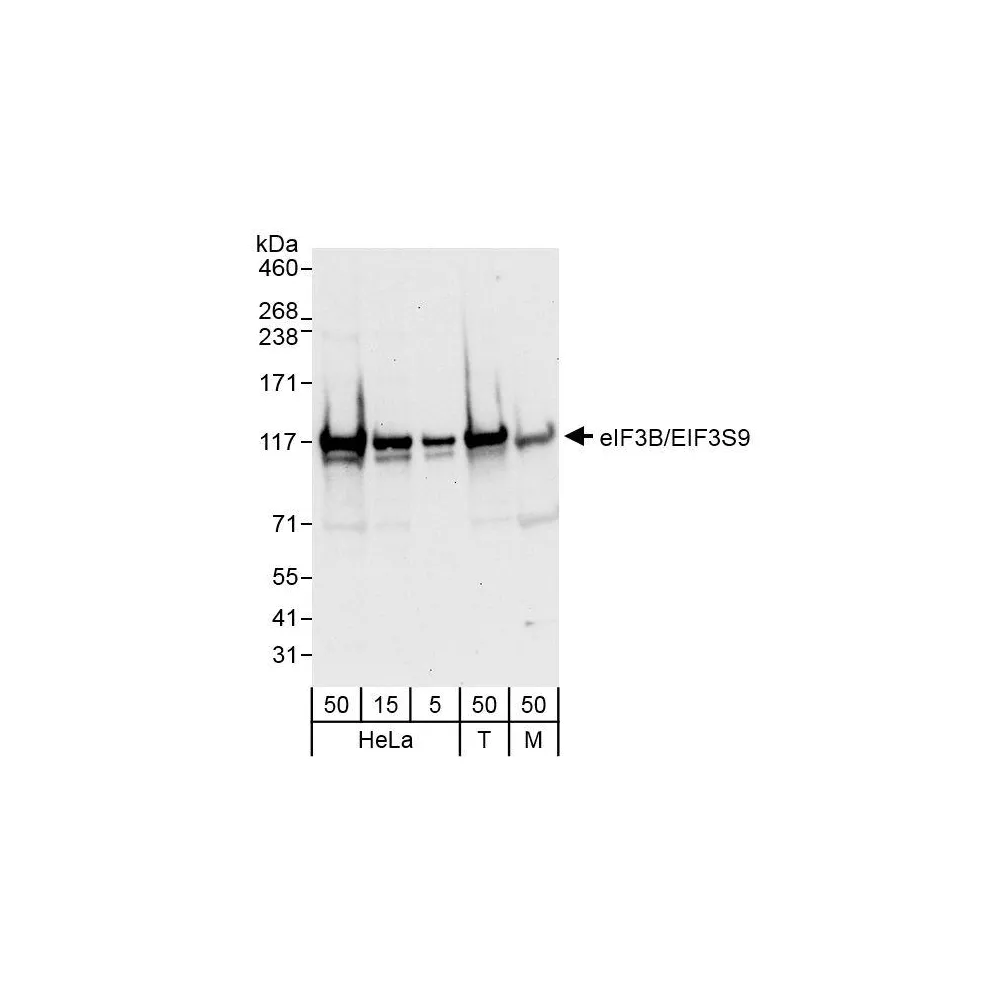 Rabbit anti-eIF3B/EIF3S9 Antibody, Affinity Purified