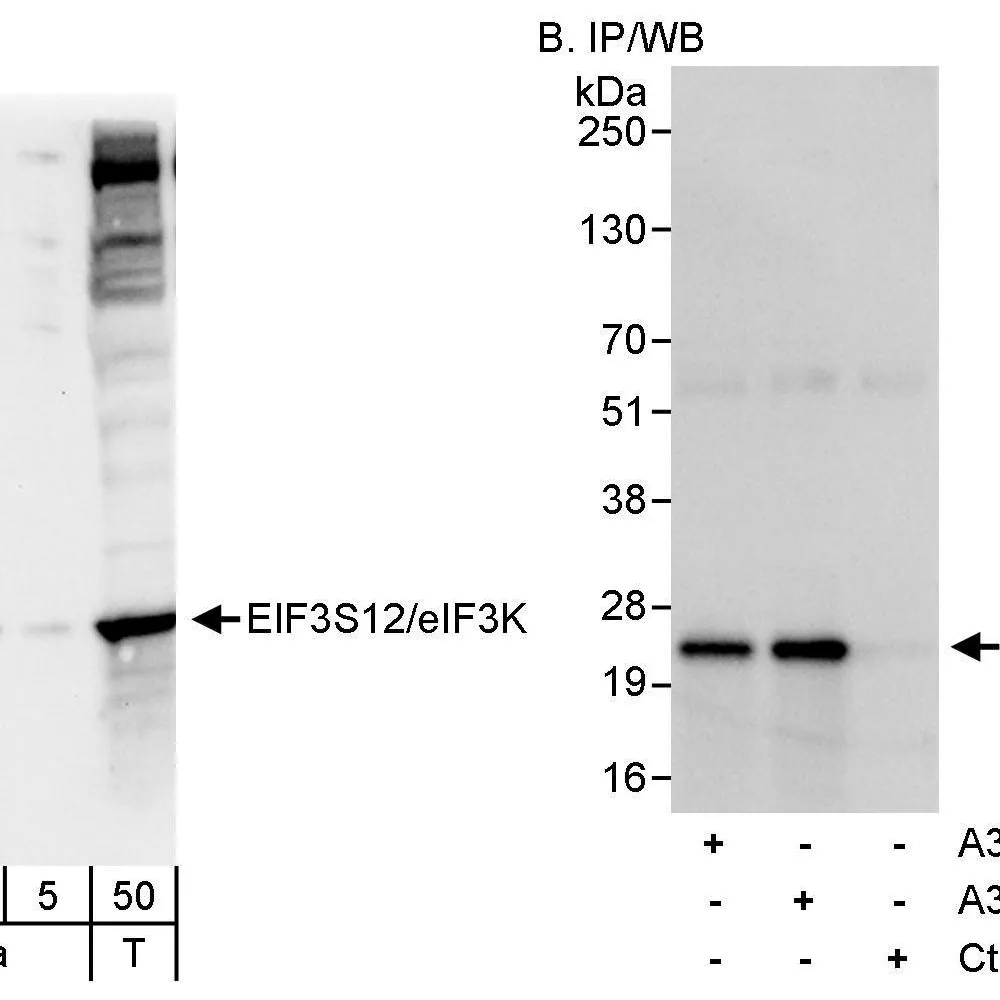 Rabbit anti-eIF3K/EIF3S12 Antibody, Affinity Purified