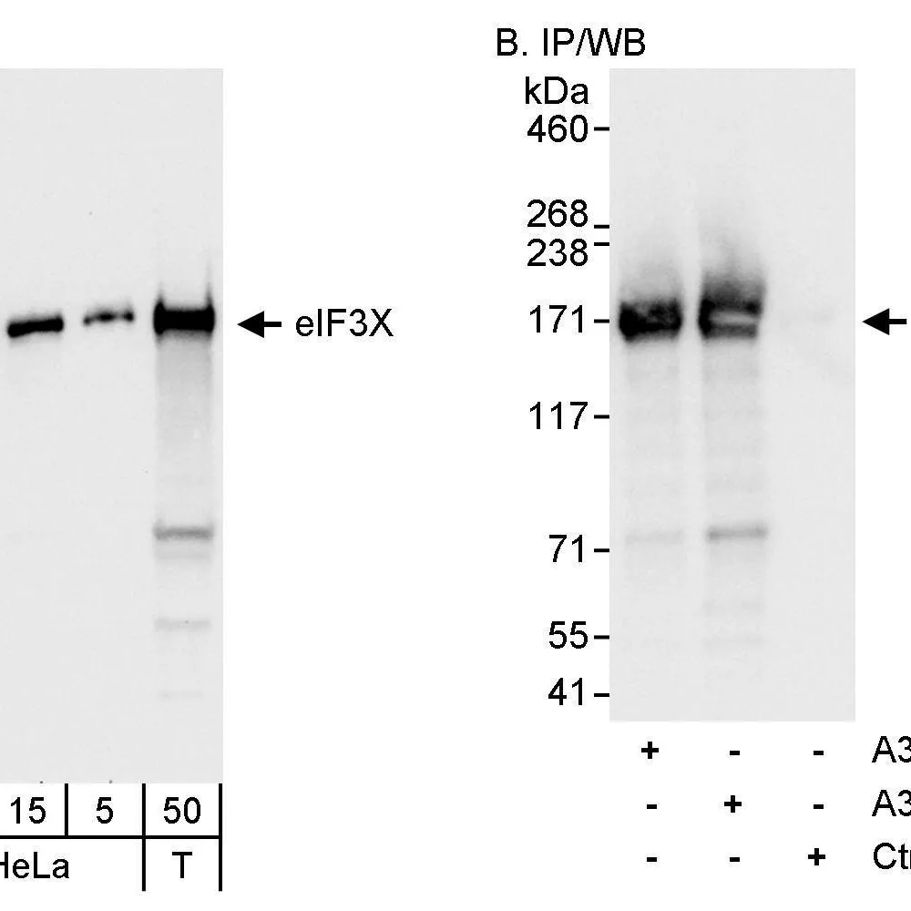Rabbit anti-eIF3X Antibody, Affinity Purified
