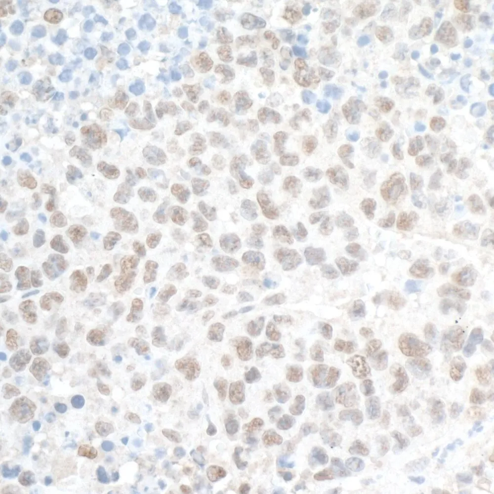 Rabbit anti-PHF8 Antibody, Affinity Purified