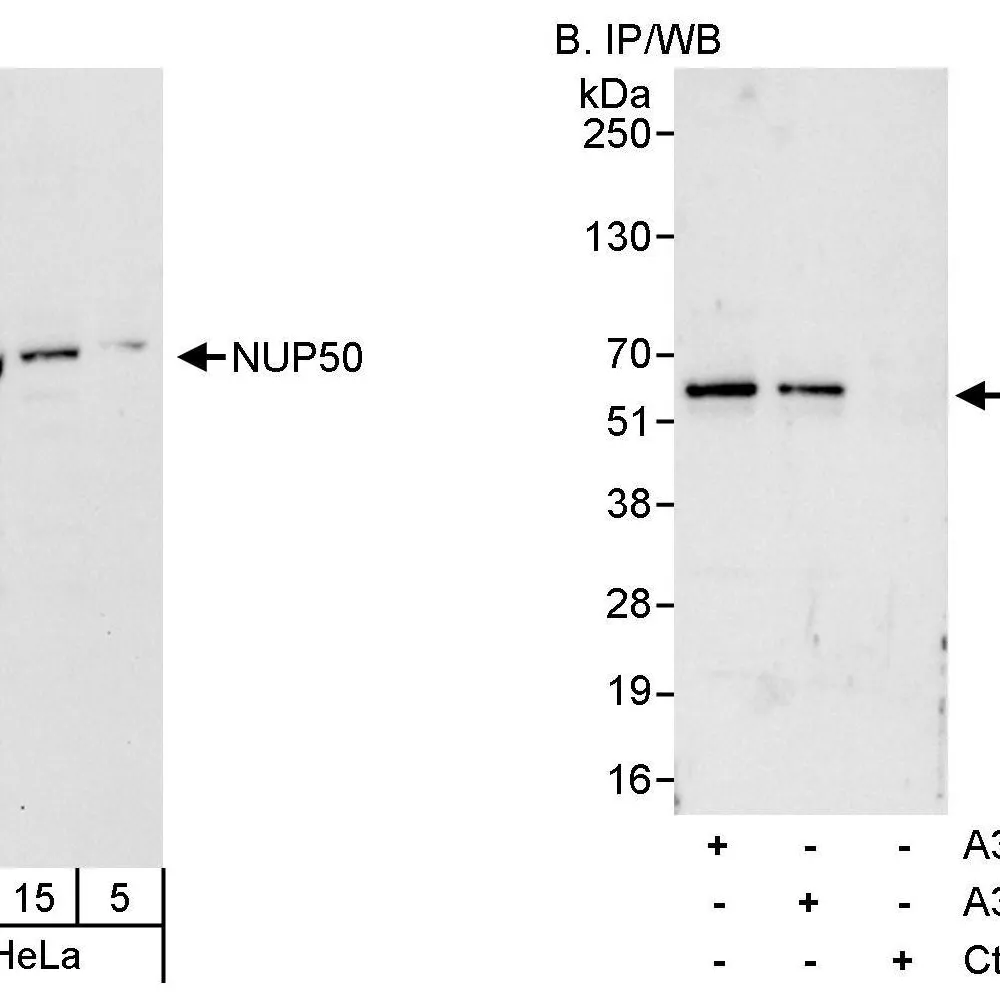Rabbit anti-NUP50 Antibody, Affinity Purified