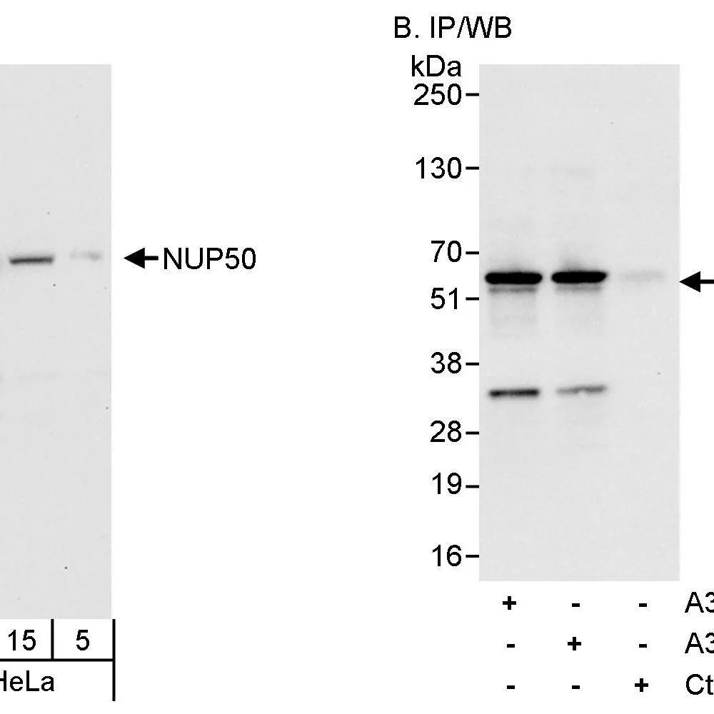 Rabbit anti-NUP50 Antibody, Affinity Purified