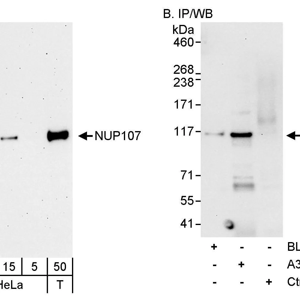 Rabbit anti-NUP107 Antibody, Affinity Purified