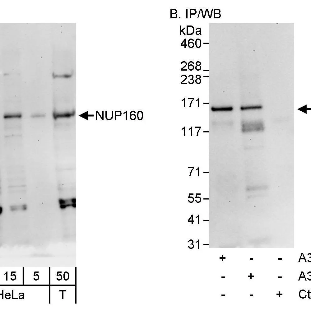 Rabbit anti-NUP160 Antibody, Affinity Purified