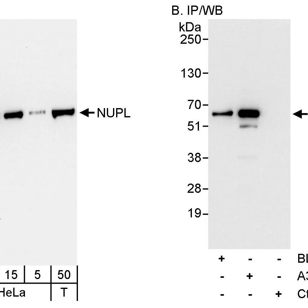 Rabbit anti-NUPL Antibody, Affinity Purified