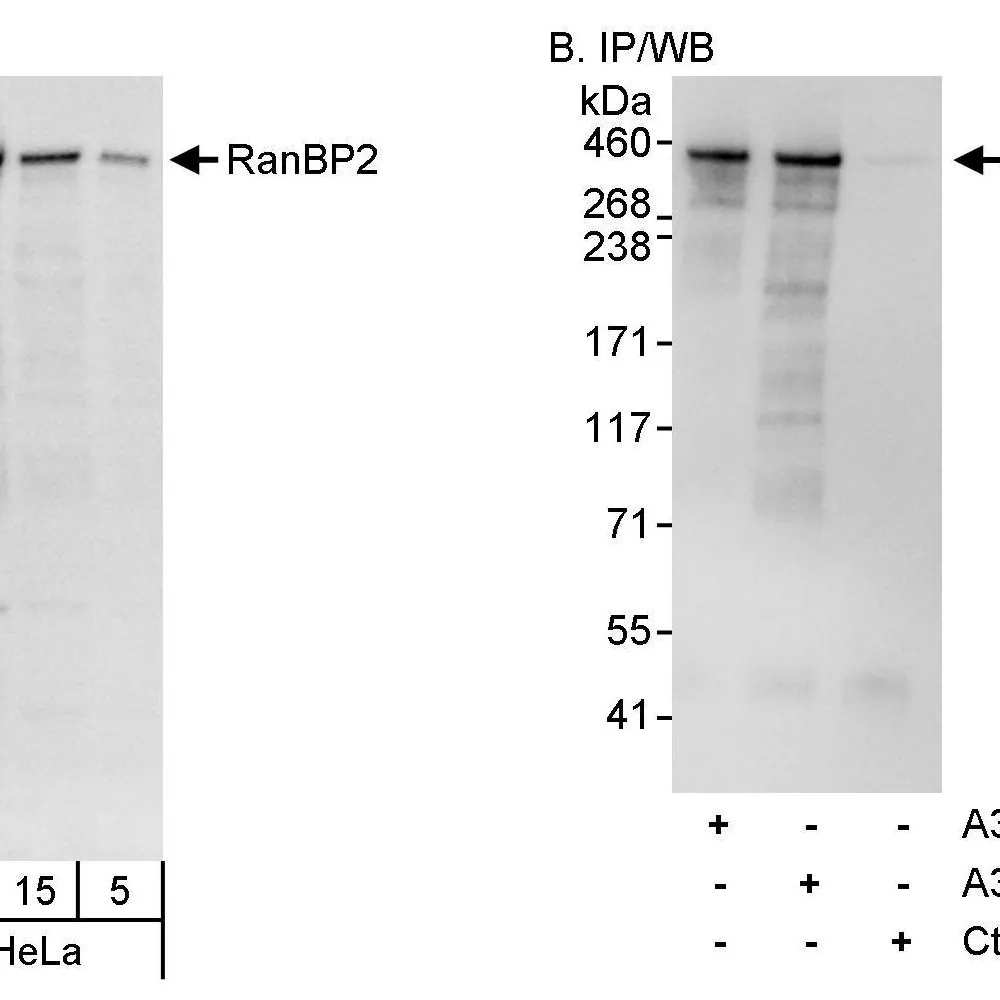 Rabbit anti-RanBP2 Antibody, Affinity Purified