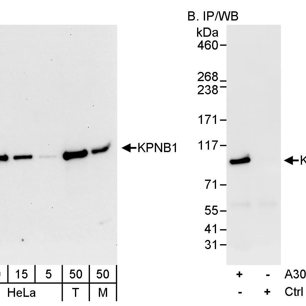 Rabbit anti-KPNB1 Antibody, Affinity Purified