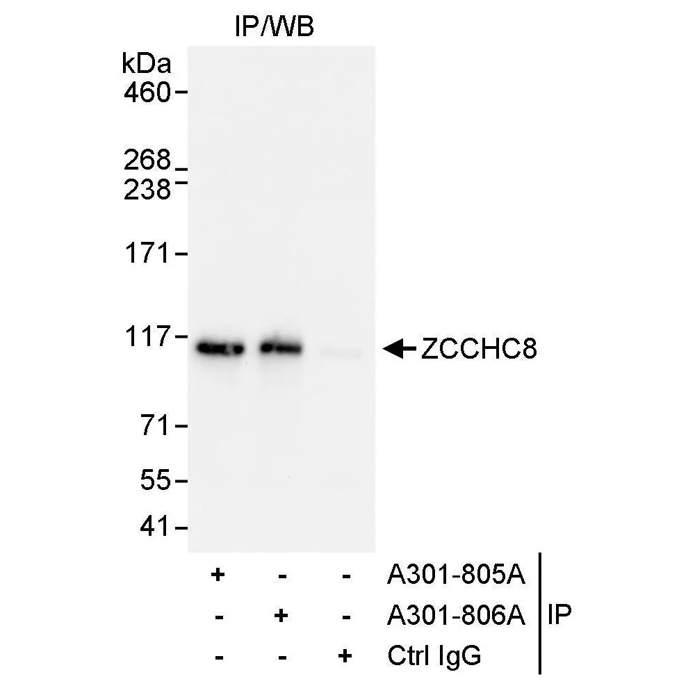 Rabbit anti-ZCCHC8 Antibody, Affinity Purified