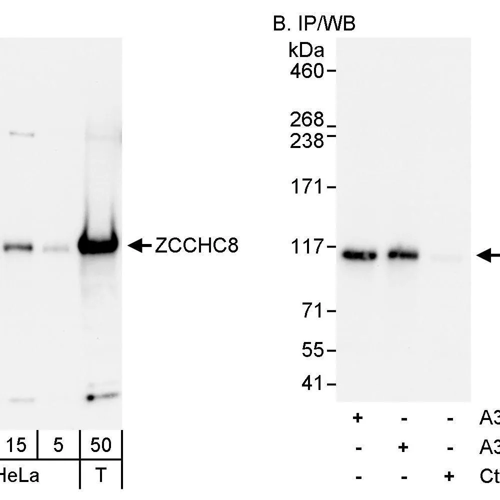 Rabbit anti-ZCCHC8 Antibody, Affinity Purified