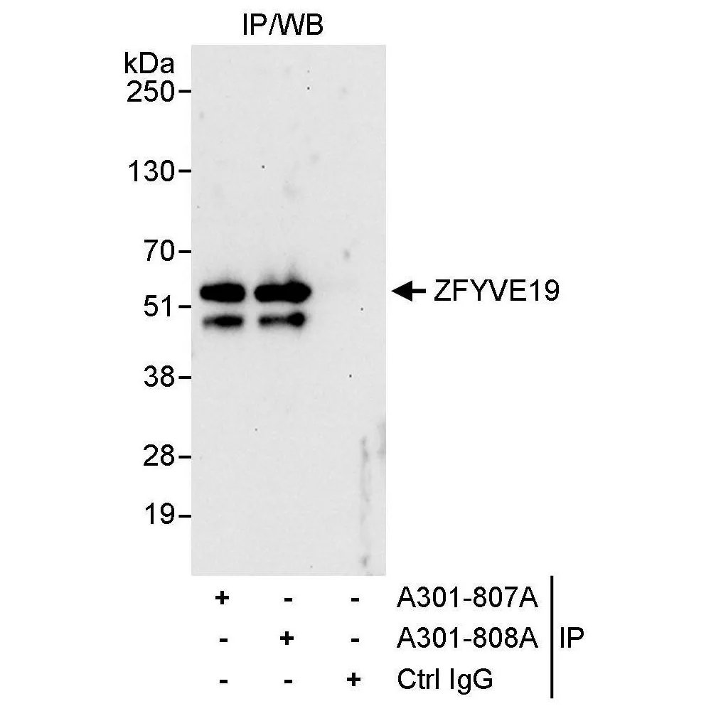 Rabbit anti-ZFYVE19 Antibody, Affinity Purified