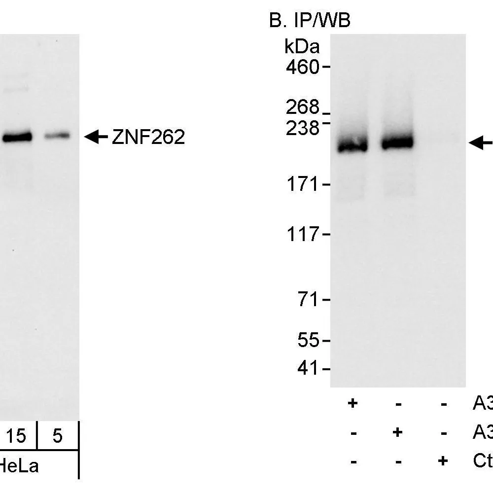 Rabbit anti-ZNF262 Antibody, Affinity Purified