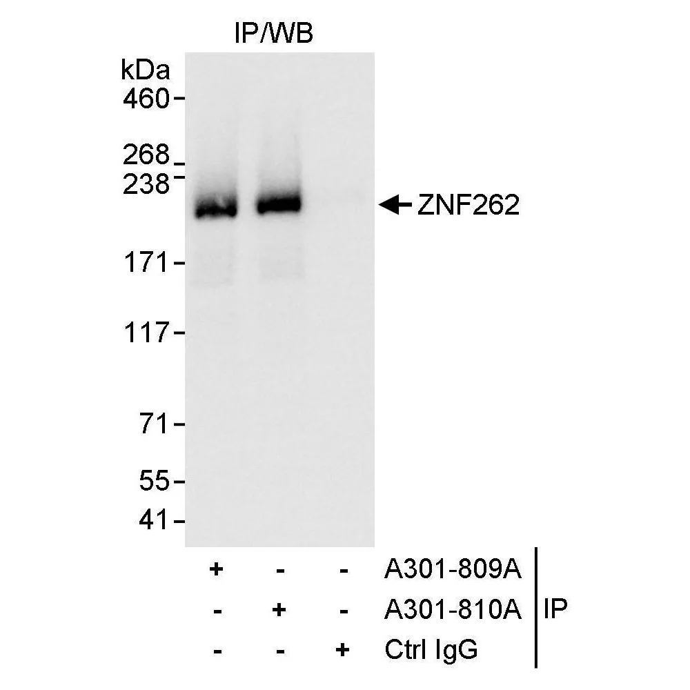 Rabbit anti-ZNF262 Antibody, Affinity Purified