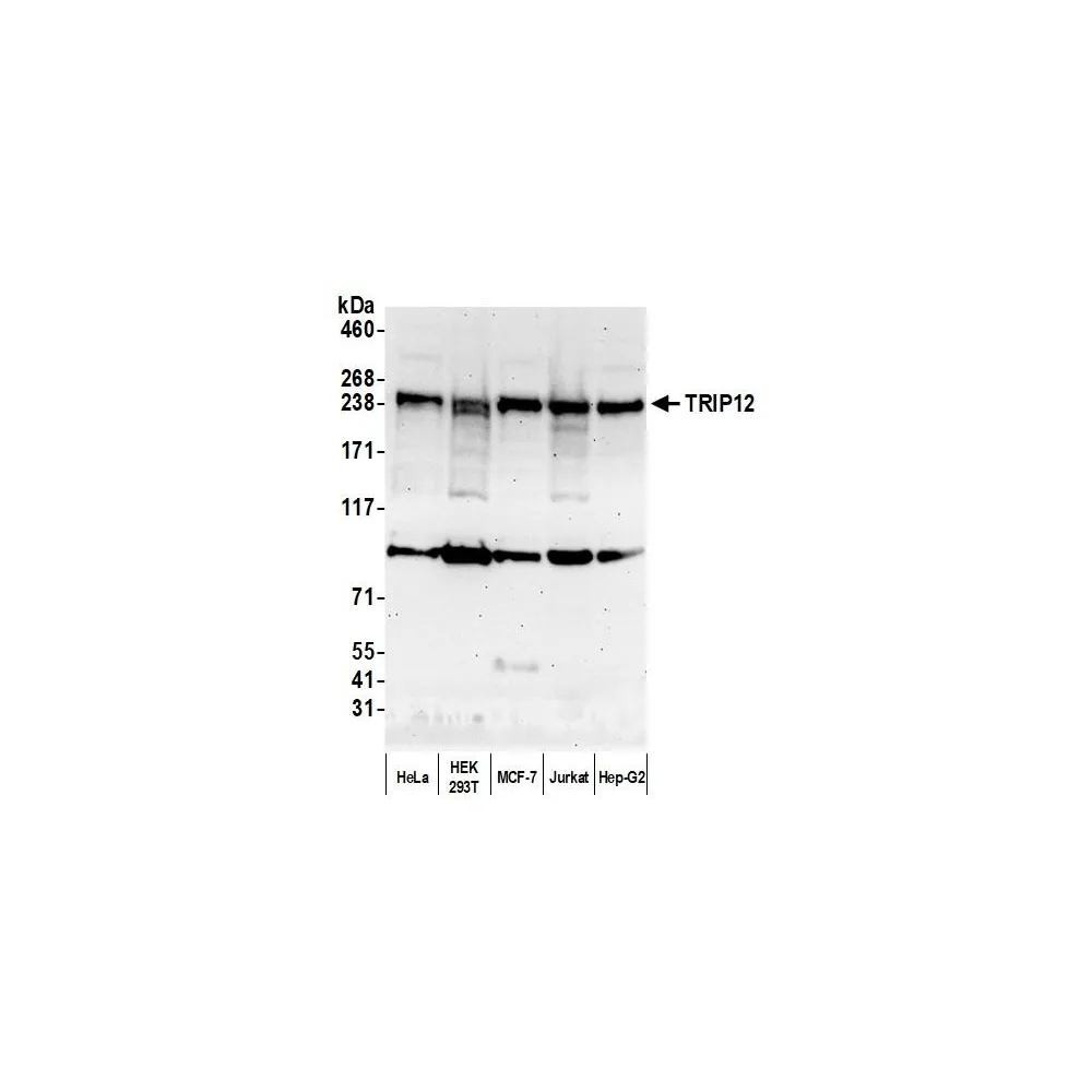 Rabbit anti-TRIP12 Antibody, Affinity Purified