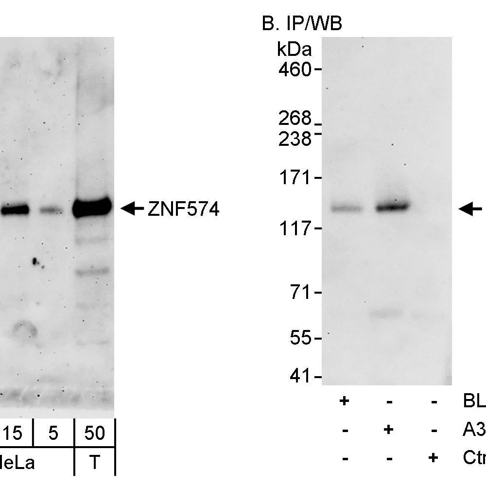 Rabbit anti-ZNF574 Antibody, Affinity Purified