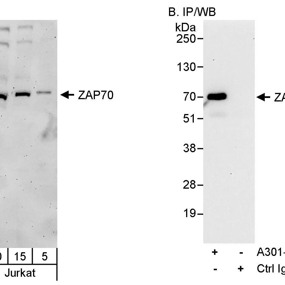 Rabbit anti-ZAP70 Antibody, Affinity Purified