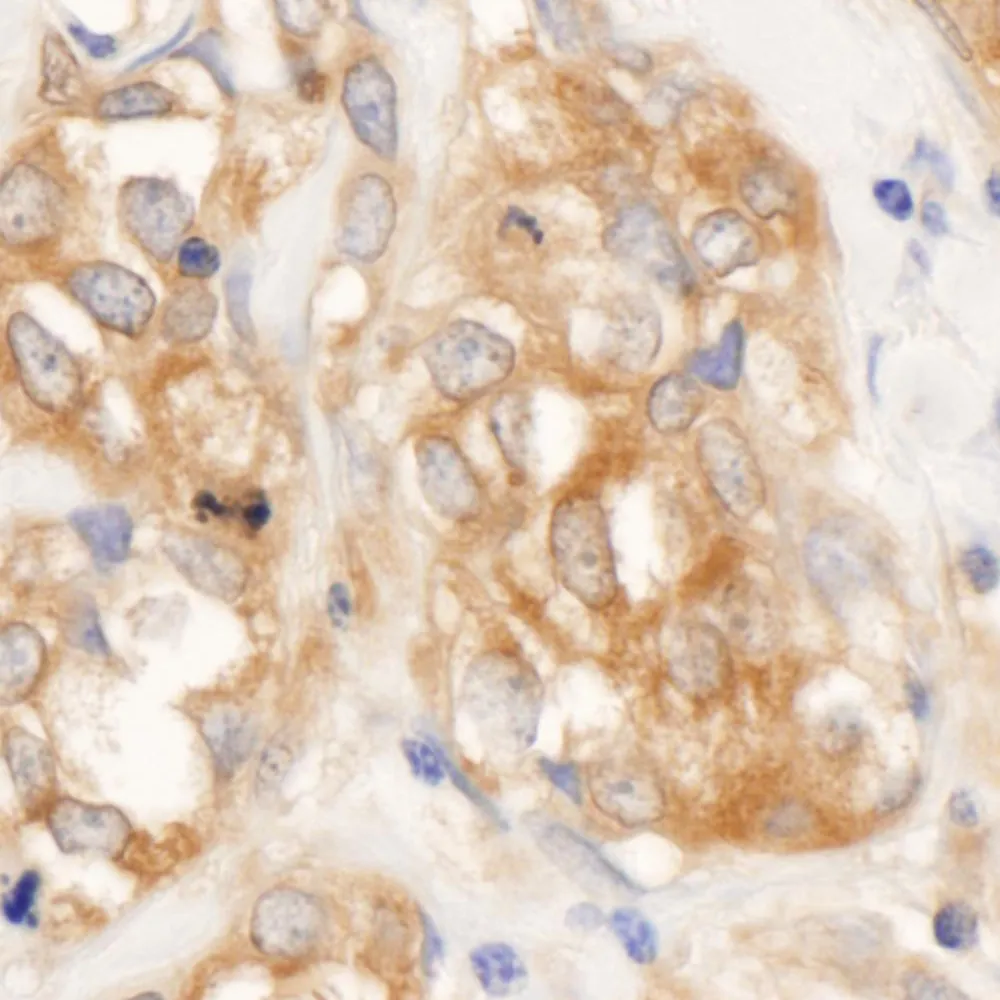 Rabbit anti-RelA Antibody, Affinity Purified