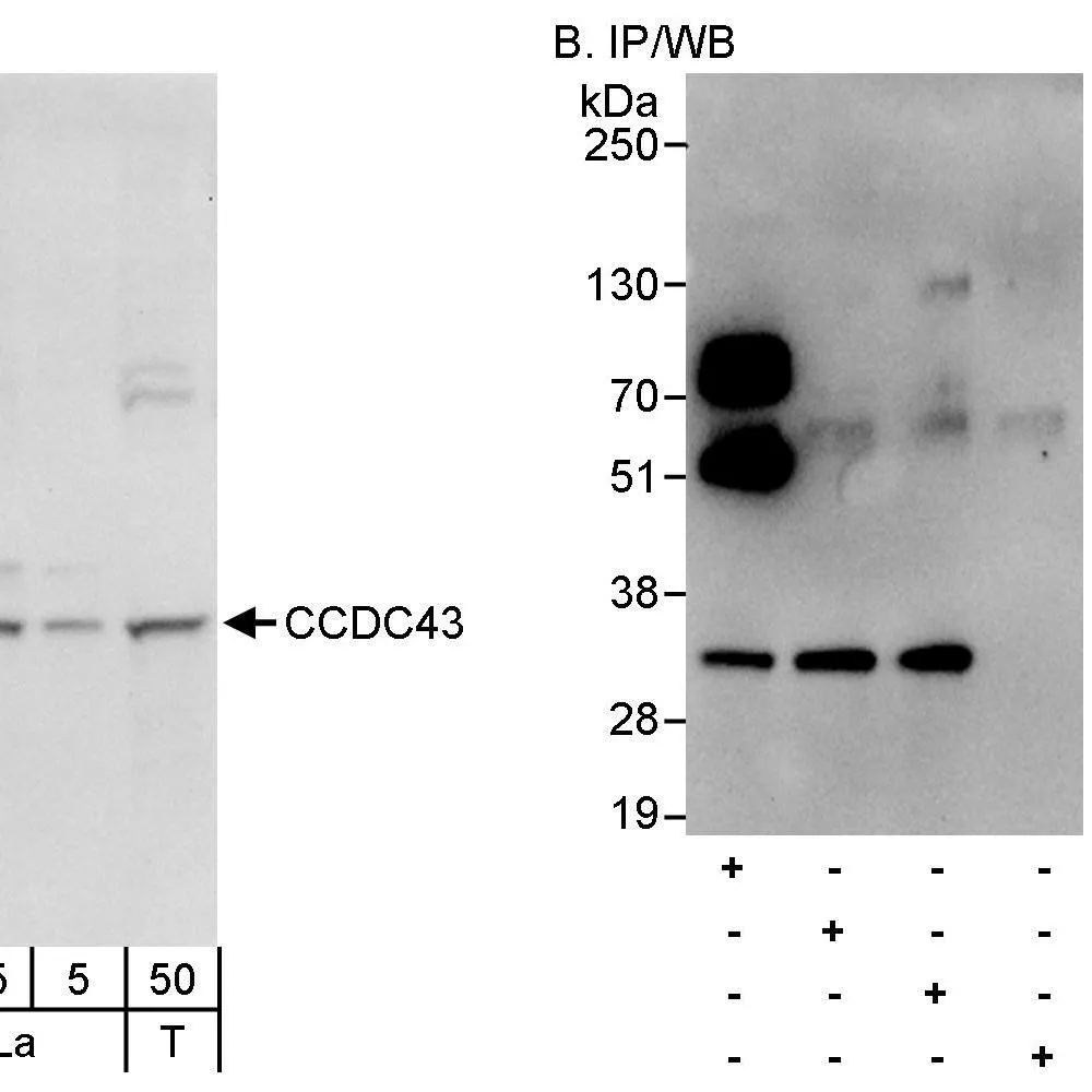 Rabbit anti-CCDC43 Antibody, Affinity Purified