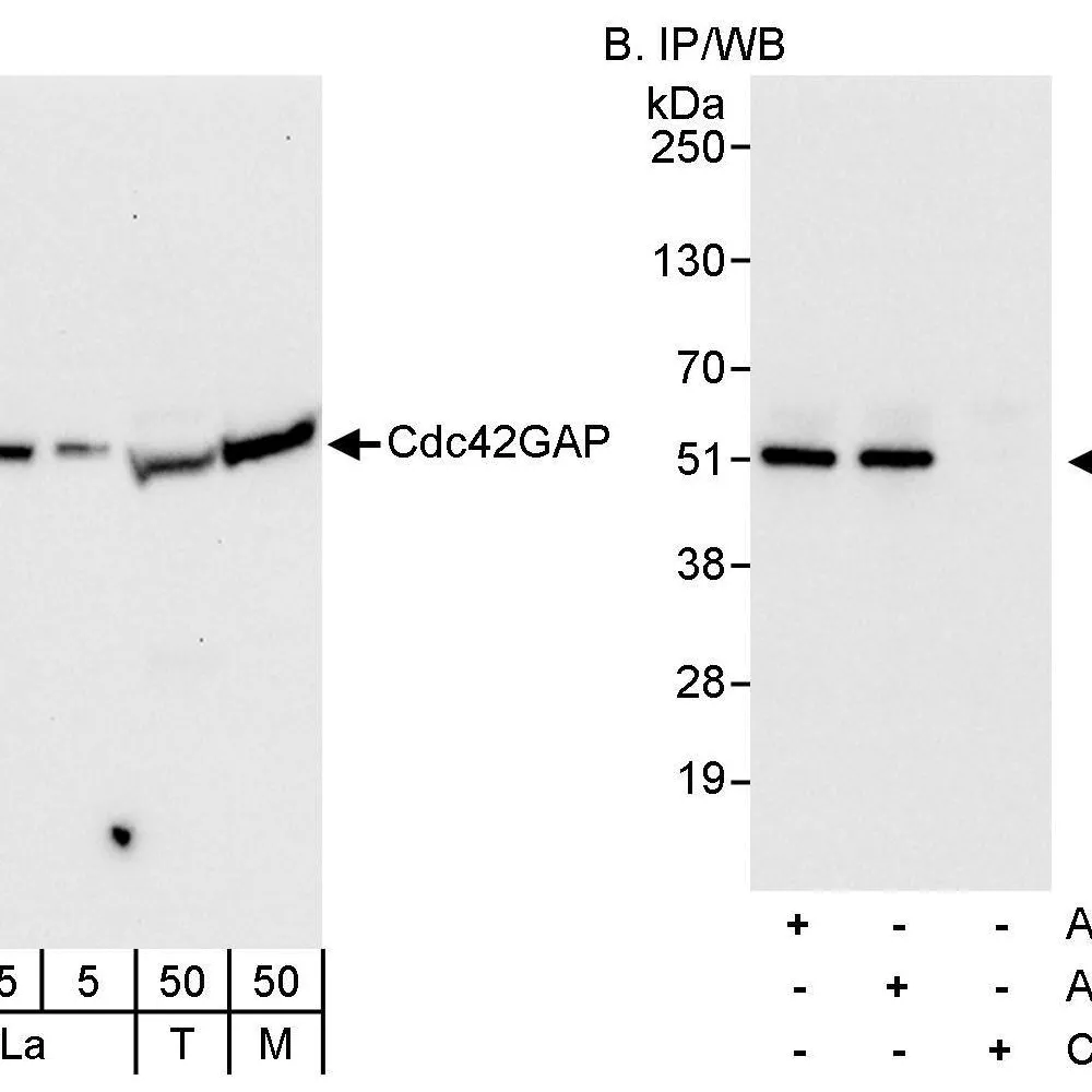 Rabbit anti-Cdc42GAP Antibody, Affinity Purified