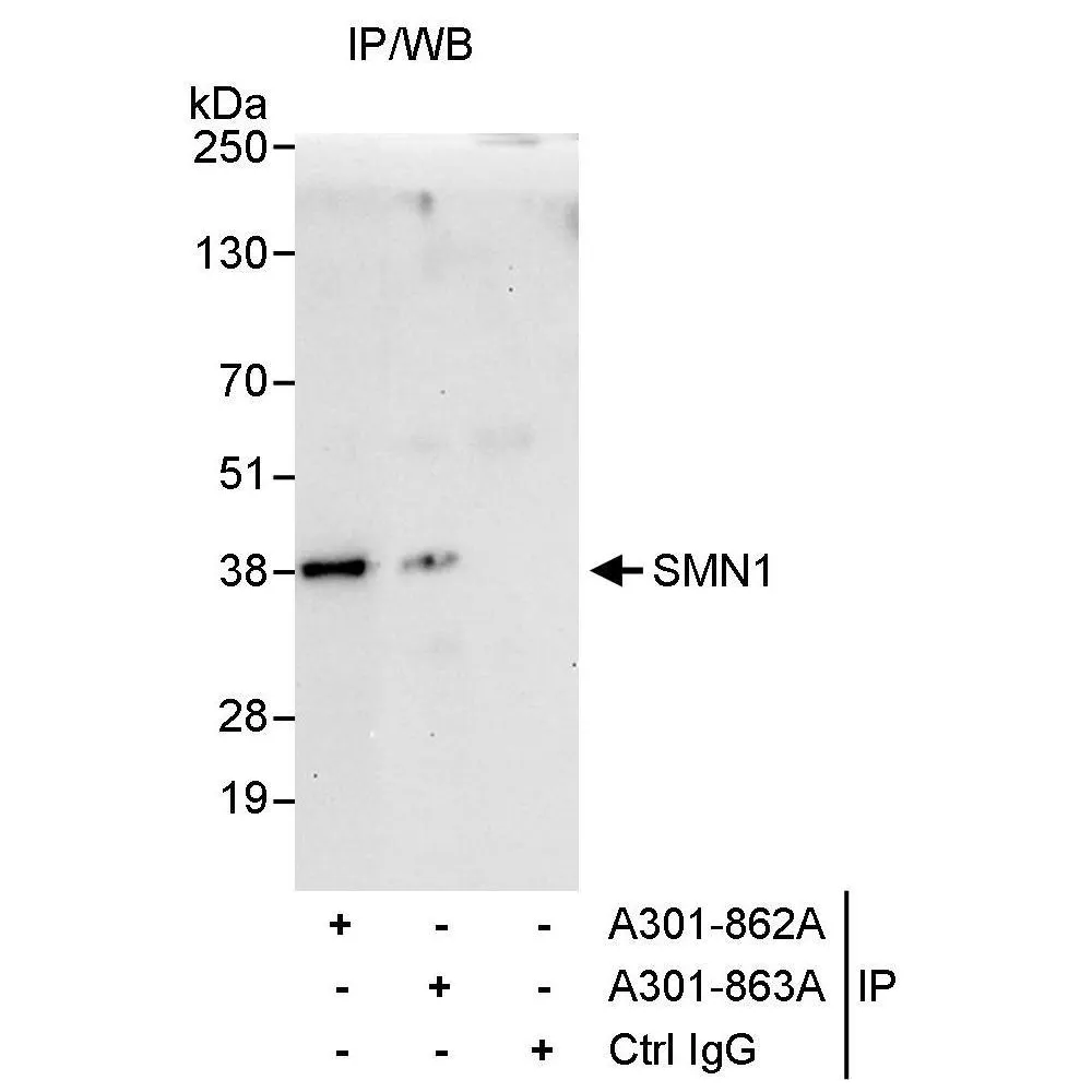Rabbit anti-SMN1 Antibody, Affinity Purified