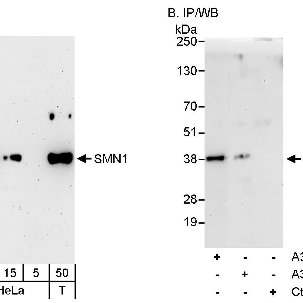 Rabbit anti-SMN1 Antibody, Affinity Purified