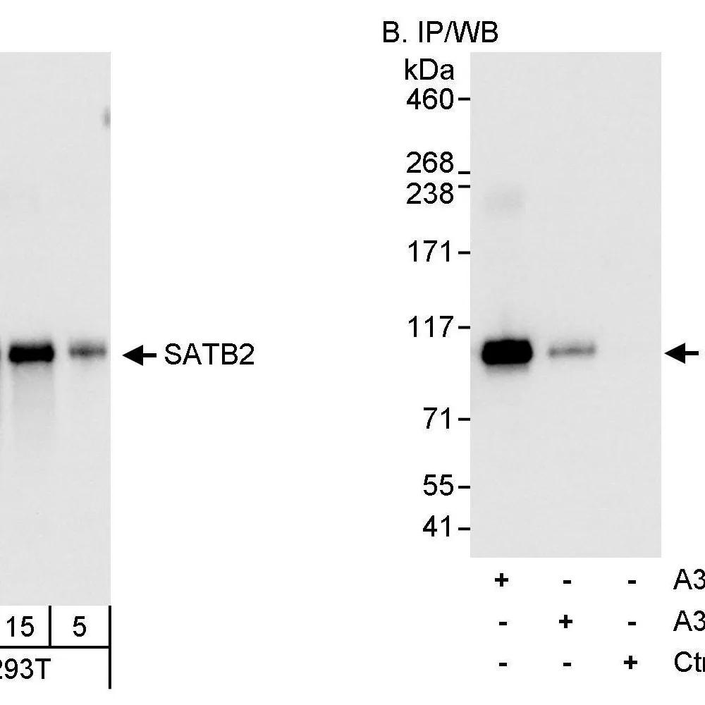 Rabbit anti-SATB2 Antibody, Affinity Purified