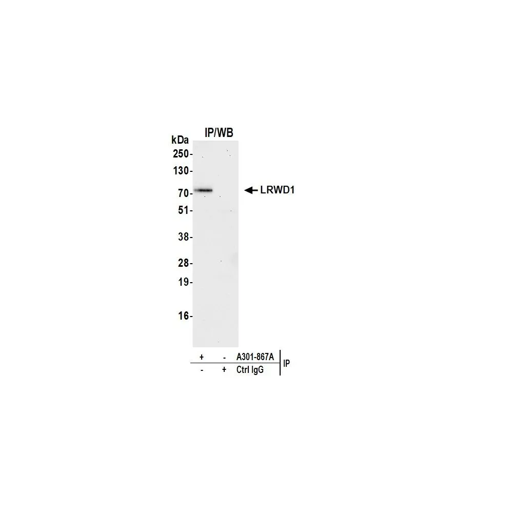 Rabbit anti-LRWD1 Antibody, Affinity Purified