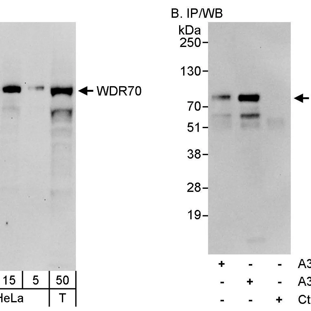Rabbit anti-WDR70 Antibody, Affinity Purified