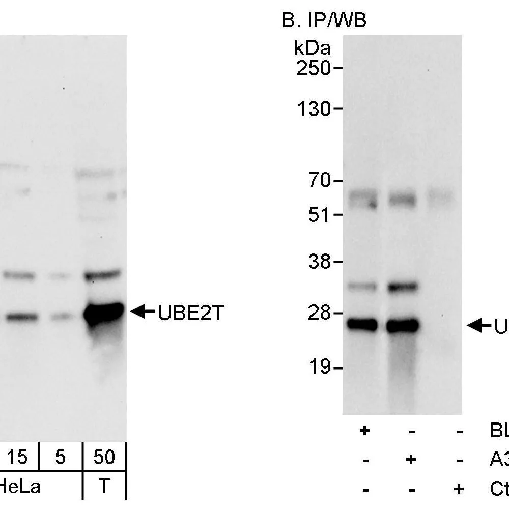Rabbit anti-UBE2T Antibody, Affinity Purified