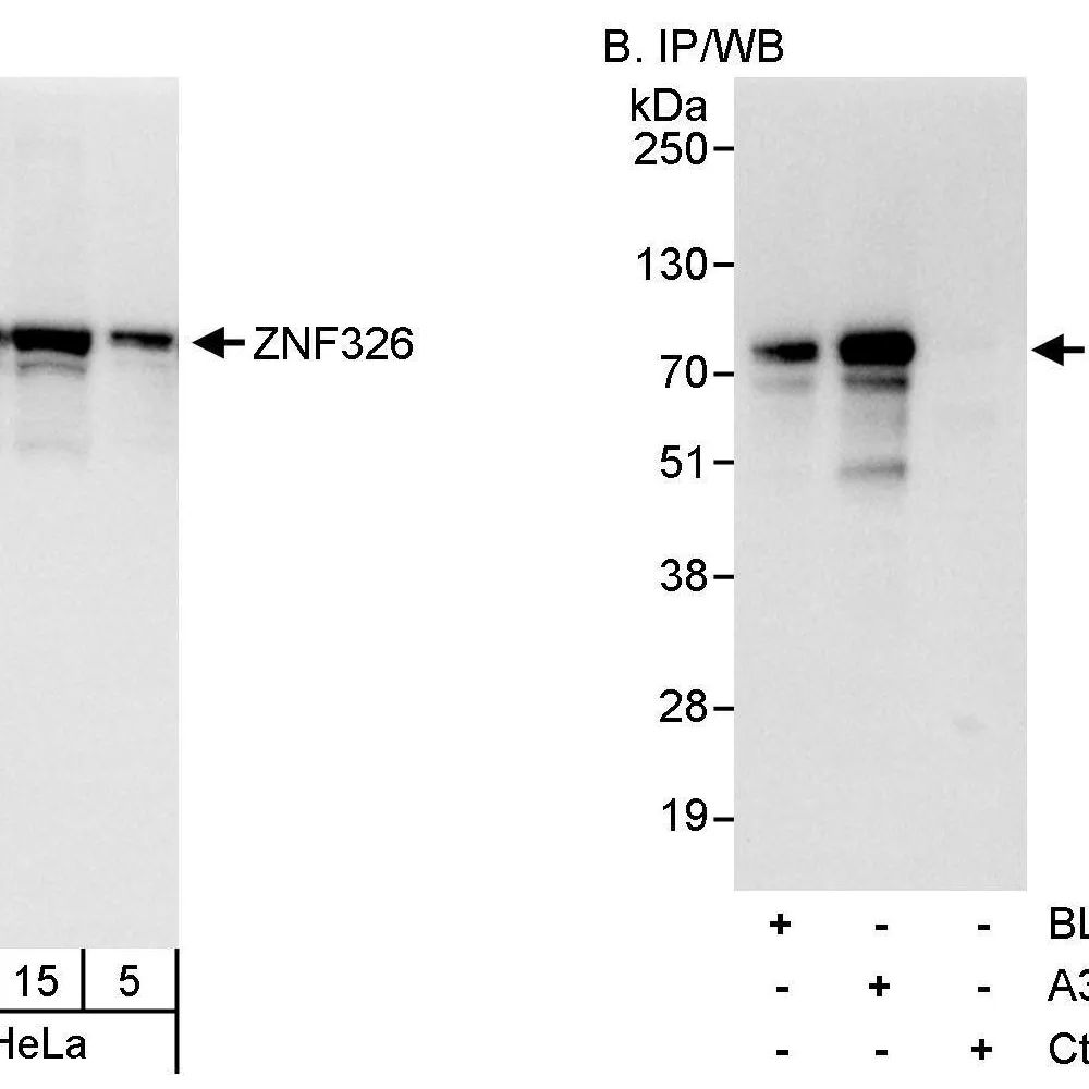 Rabbit anti-ZNF326 Antibody, Affinity Purified
