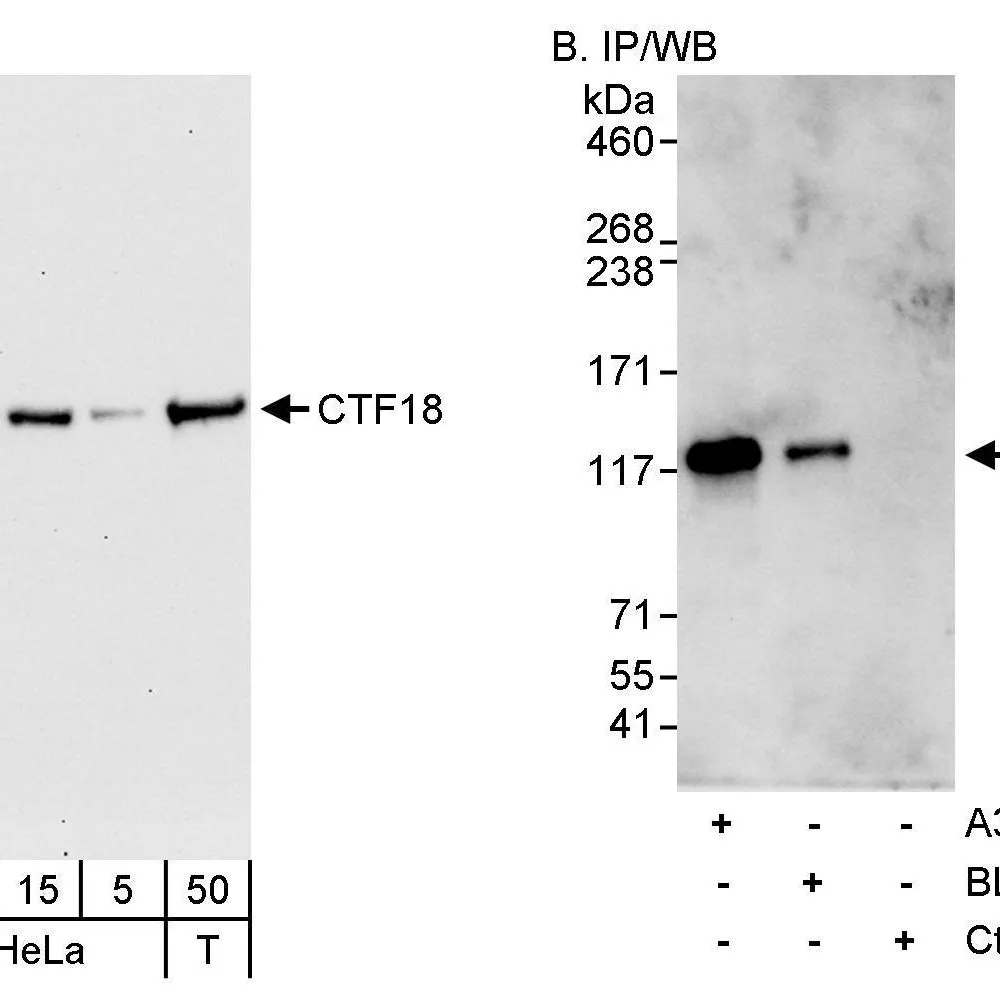 Rabbit anti-CTF18 Antibody, Affinity Purified