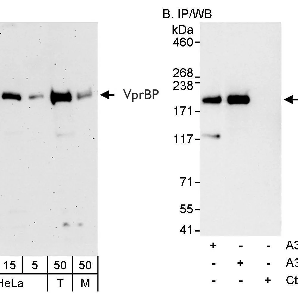 Rabbit anti-VprBP Antibody, Affinity Purified