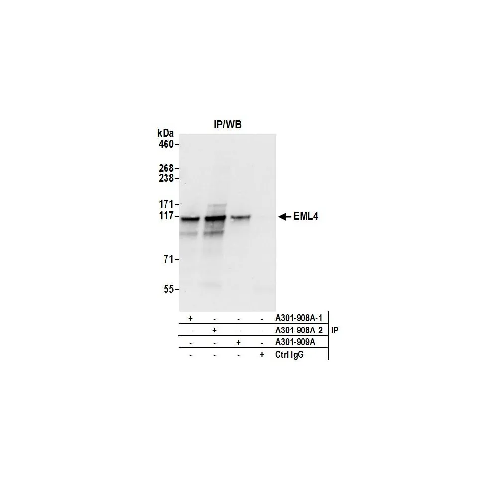 Rabbit anti-EML4 Antibody, Affinity Purified