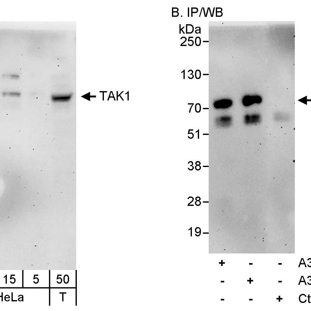 Rabbit anti-TAK1 Antibody, Affinity Purified