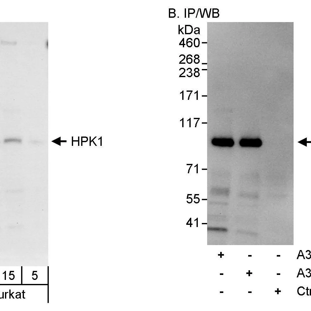 Rabbit anti-HPK1 Antibody, Affinity Purified