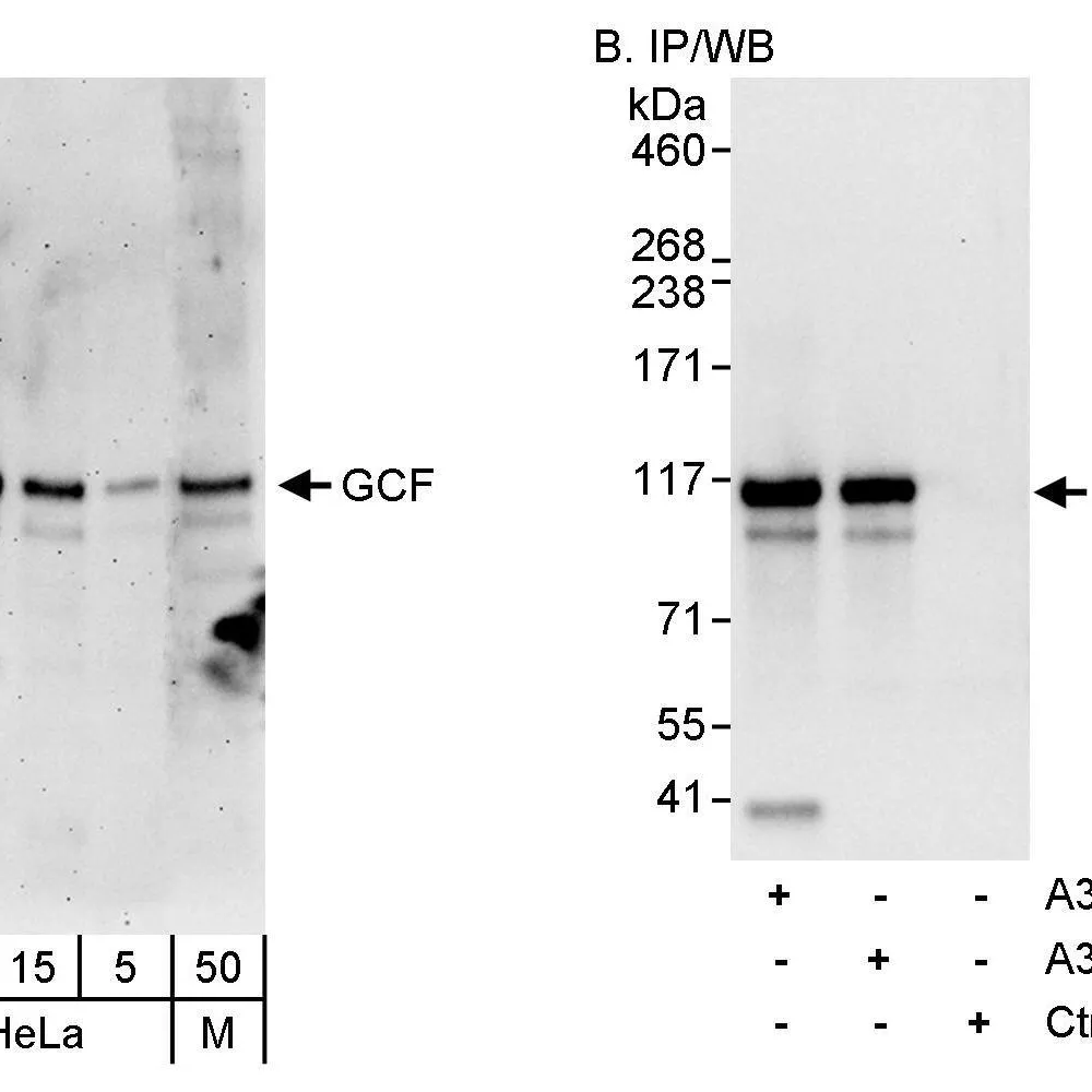Rabbit anti-GCF Antibody, Affinity Purified