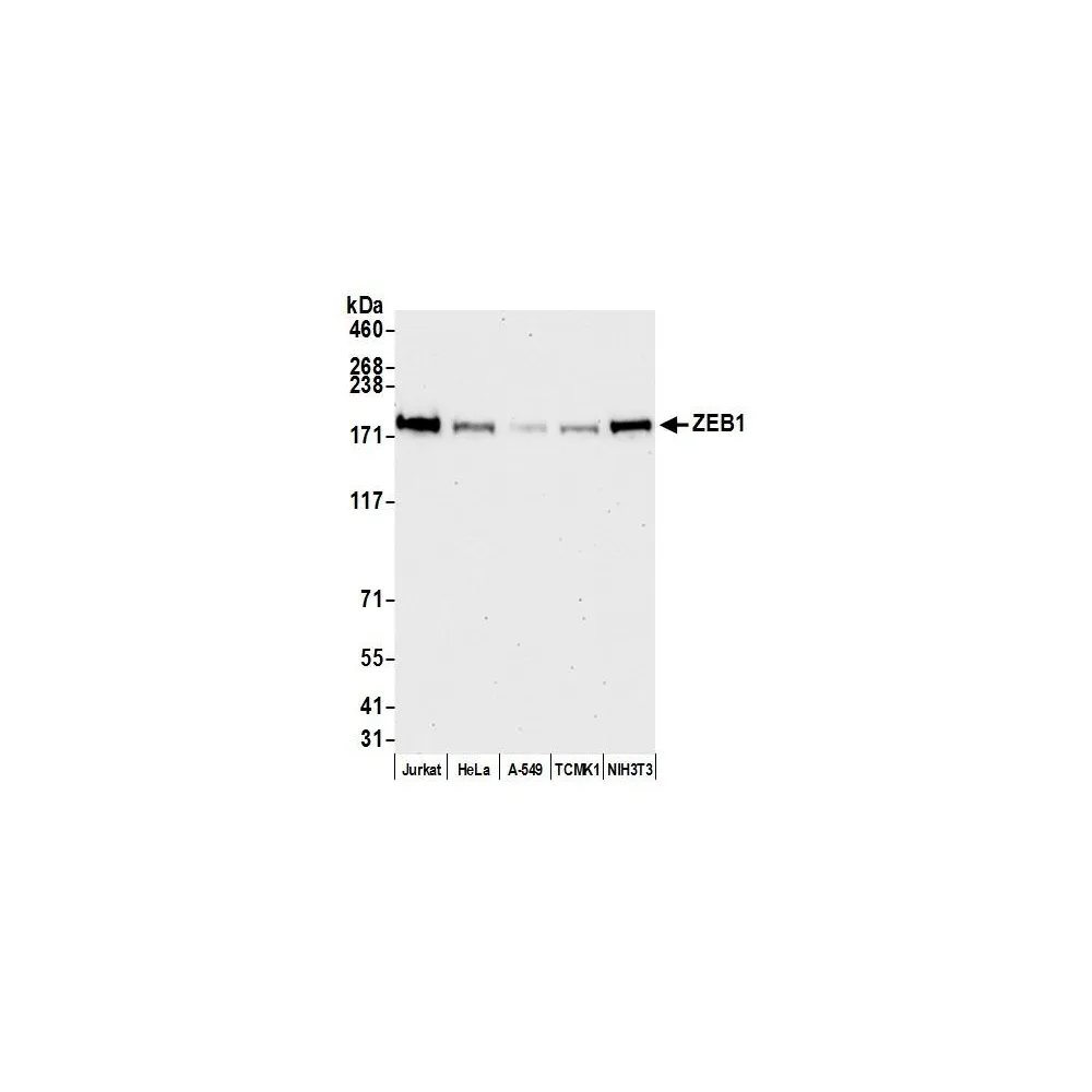 Rabbit anti-ZEB1 Antibody, Affinity Purified