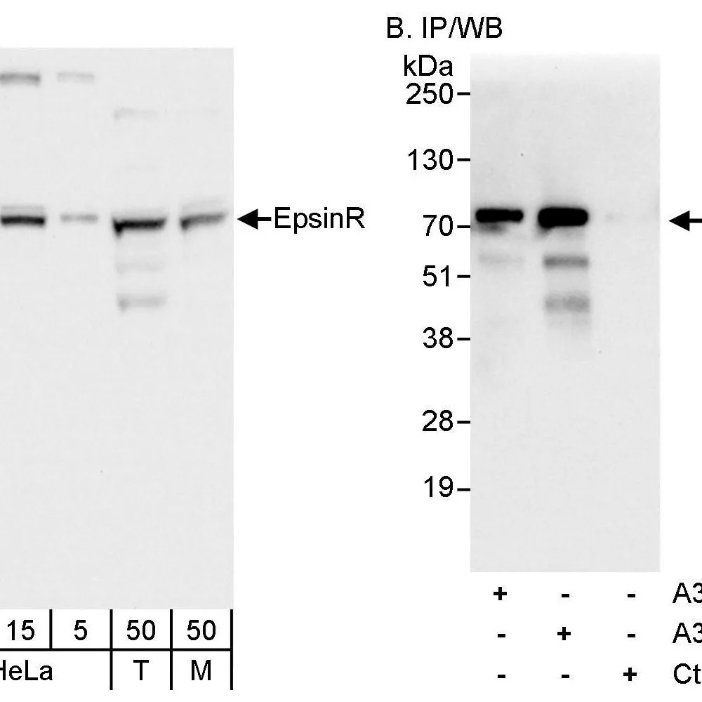 Rabbit anti-EpsinR Antibody, Affinity Purified