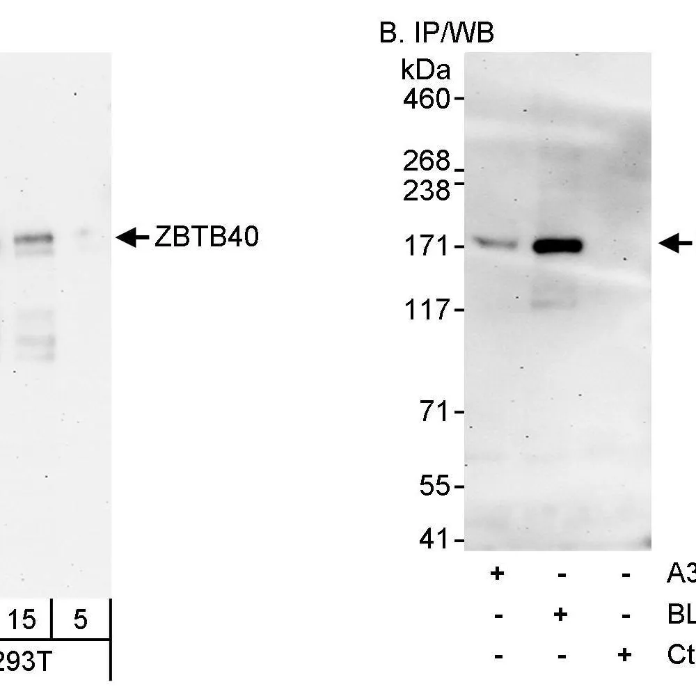 Rabbit anti-ZBTB40 Antibody, Affinity Purified
