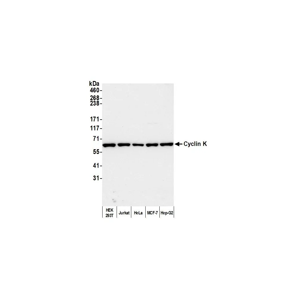 Rabbit anti-Cyclin K Antibody, Affinity Purified