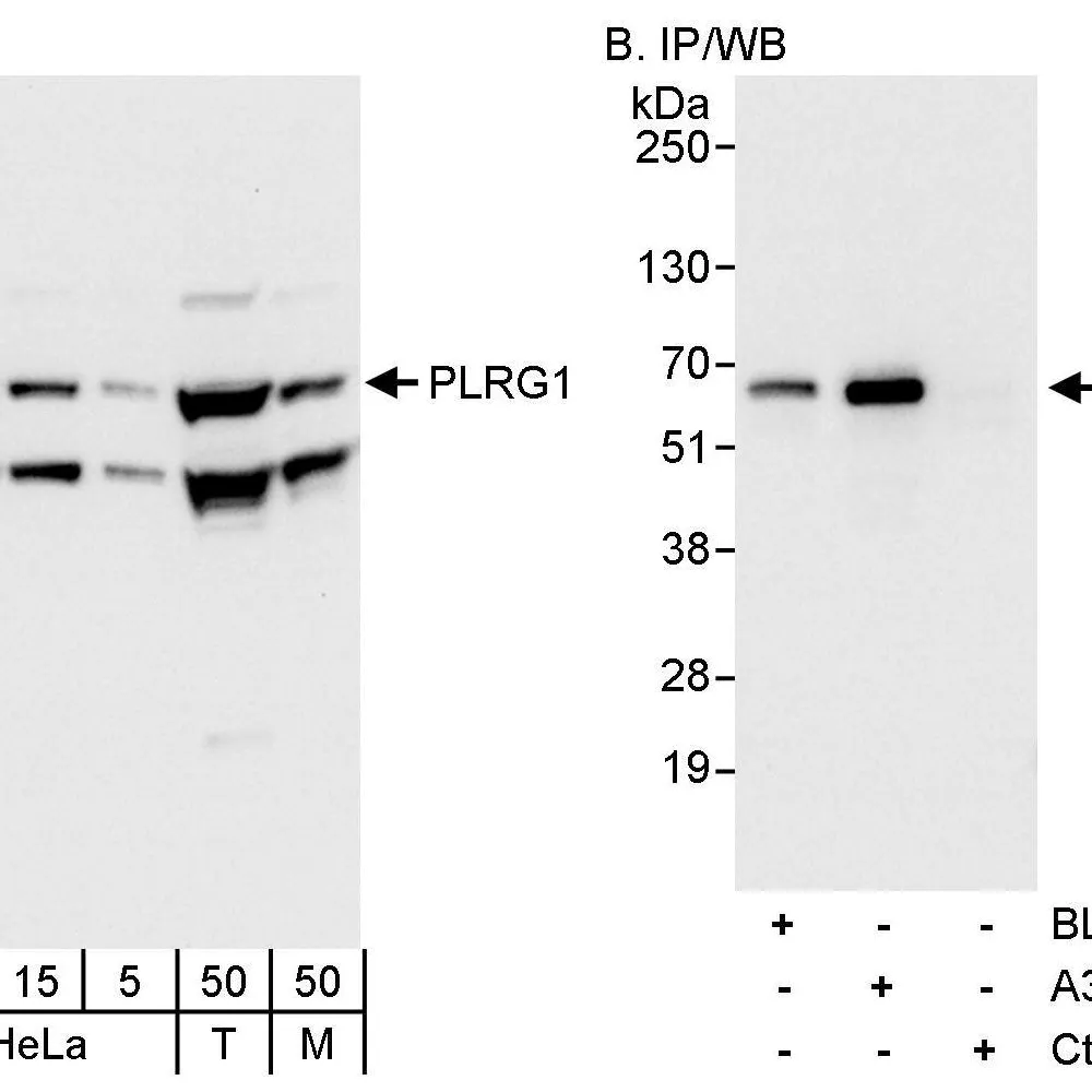 Rabbit anti-PLRG1 Antibody, Affinity Purified