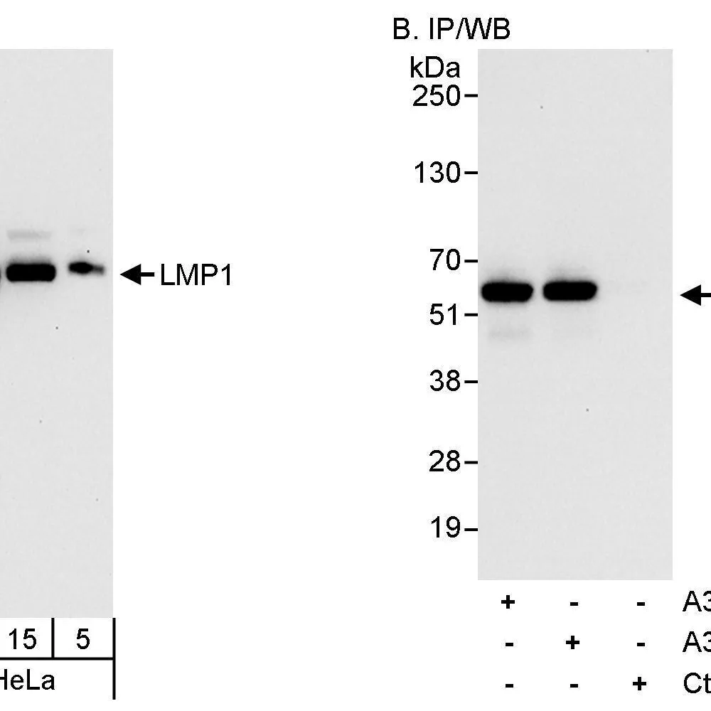 Rabbit anti-LMP1 Antibody, Affinity Purified