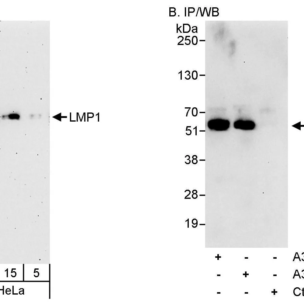 Rabbit anti-LMP1 Antibody, Affinity Purified