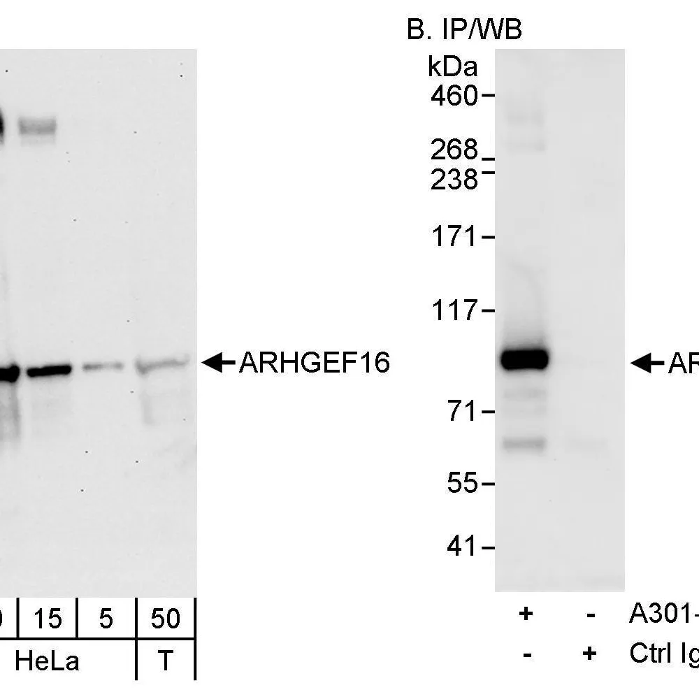Rabbit anti-ARHGEF16 Antibody, Affinity Purified