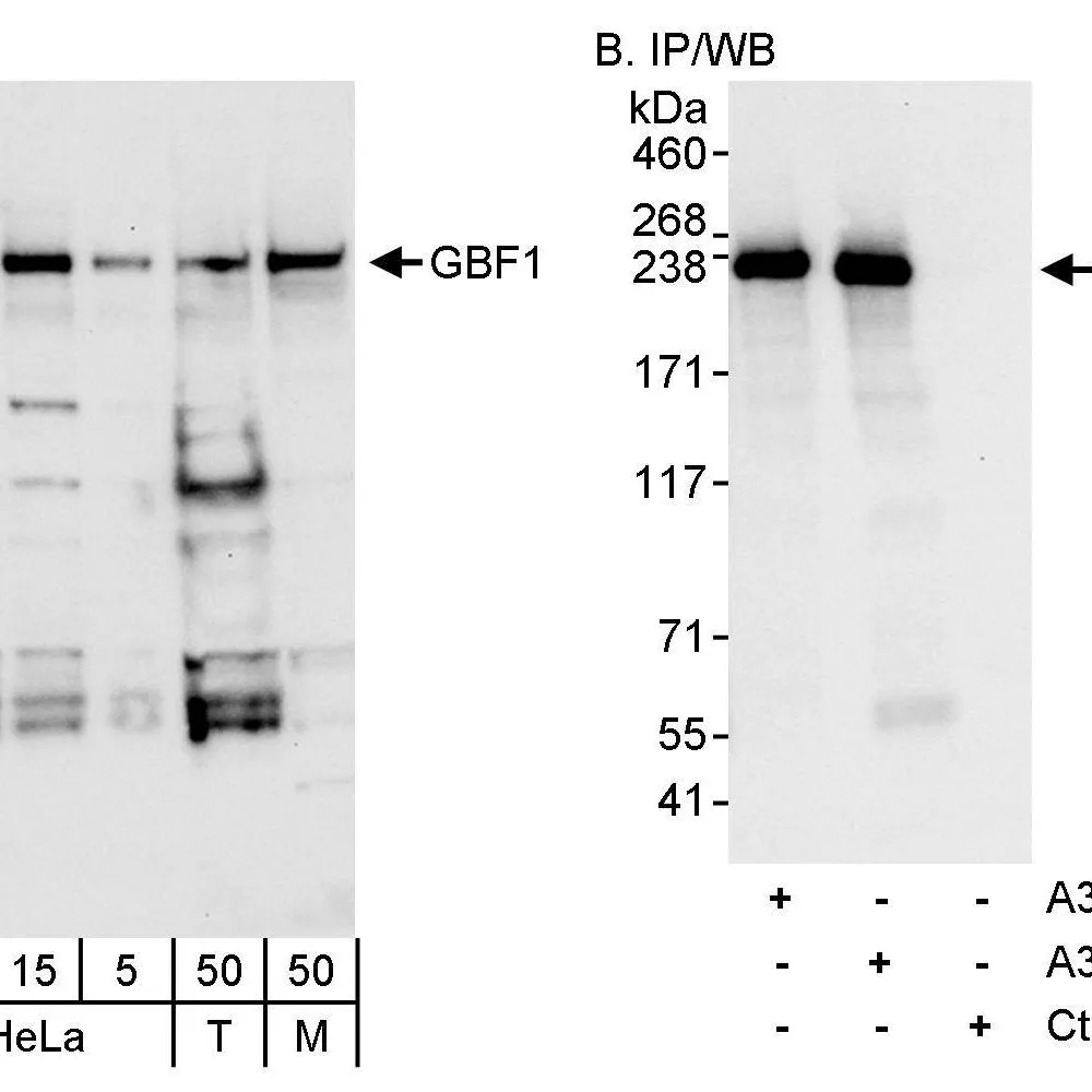 Rabbit anti-GBF1 Antibody, Affinity Purified