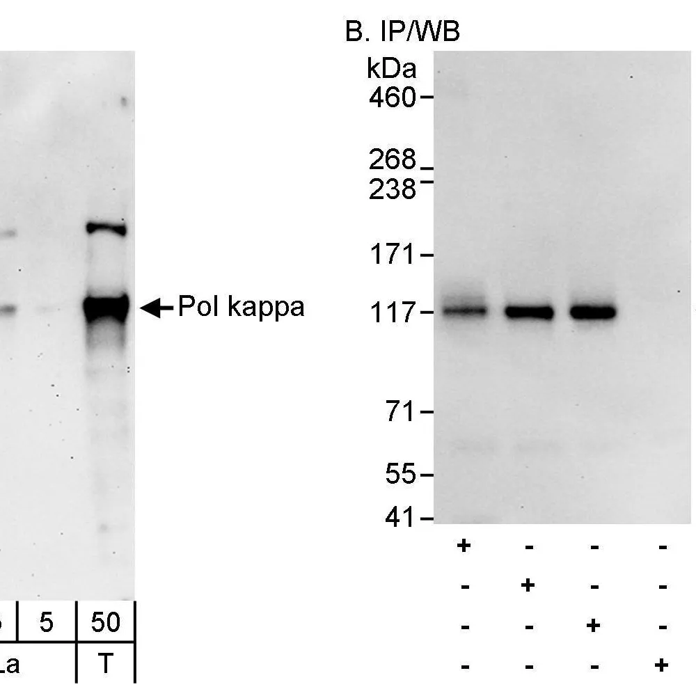 Rabbit anti-Pol kappa Antibody, Affinity Purified