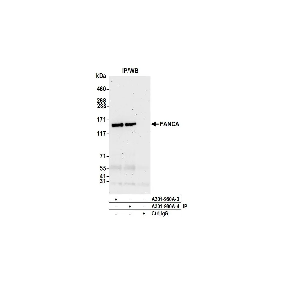 Rabbit anti-FANCA Antibody, Affinity Purified